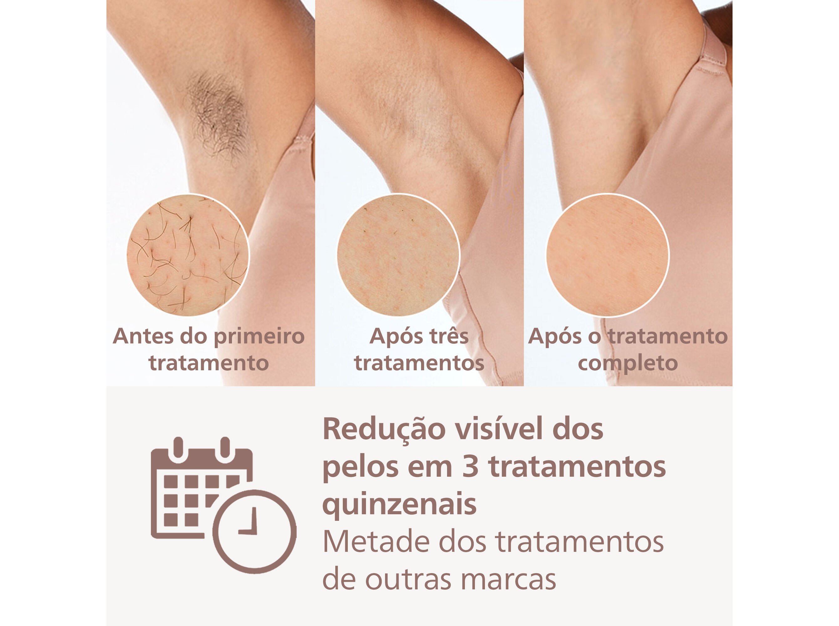 DEPILADORA IPL PHILIPS BRI940/00 LUMEA PRESTIGE image number 2