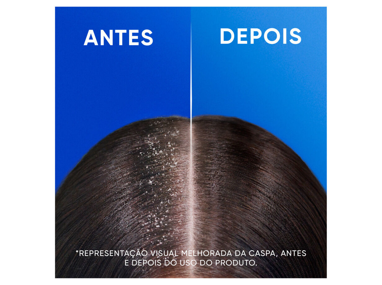 CHAMP&Ocirc; H&S MENTOL 330ML image number 4