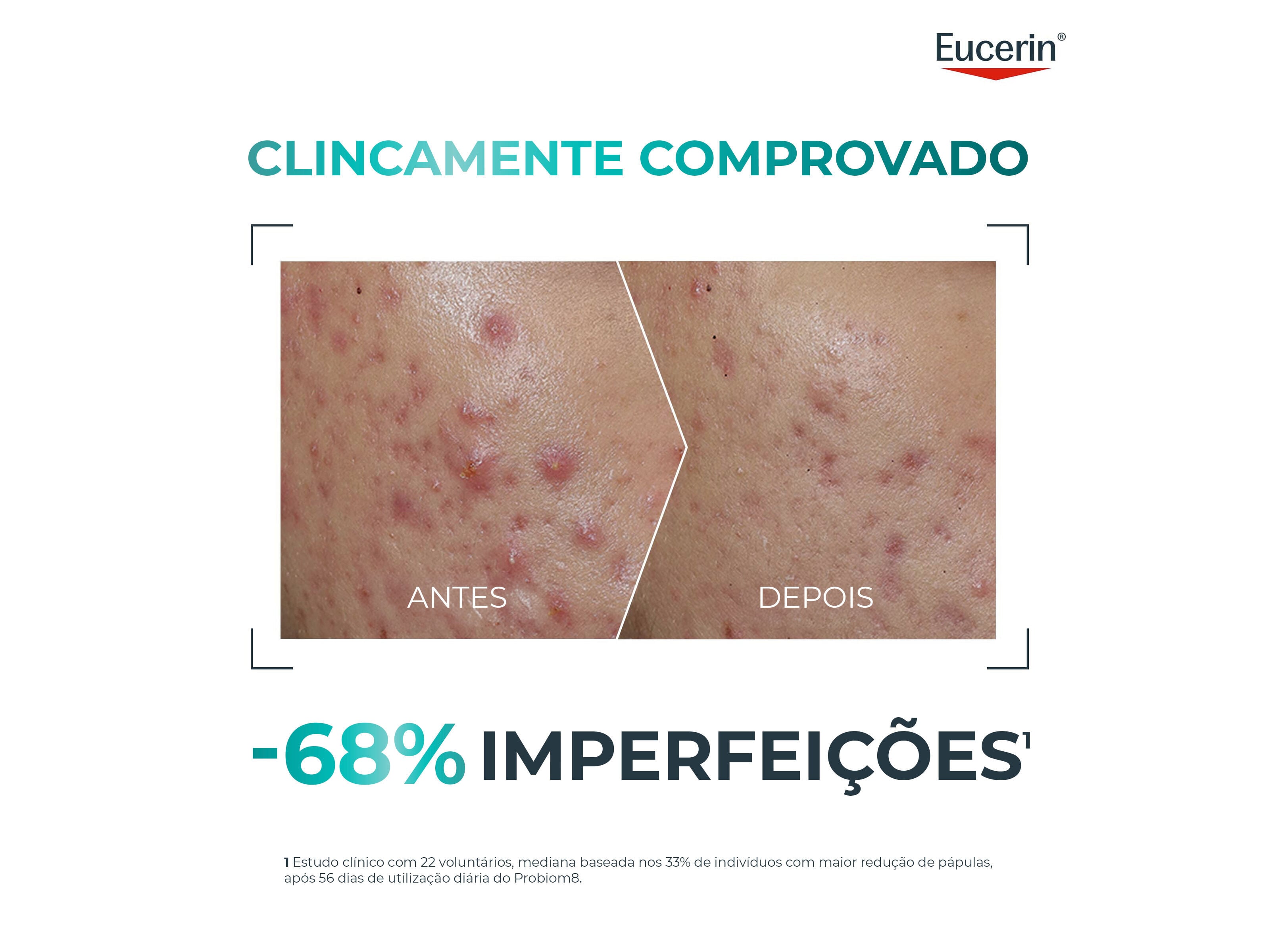 TRATAMENTO EUCERIN DERMOPURE PROBIOM8 8UN image number 2