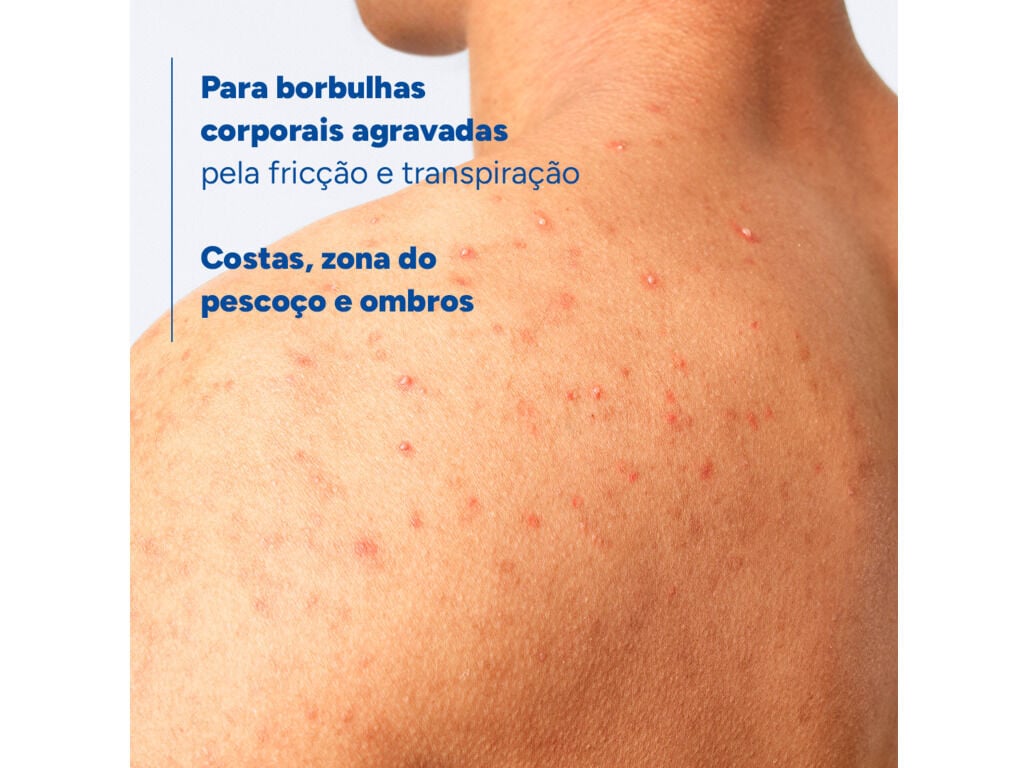 SPRAY DUCRAY KERACNYL CORPO 150ML image number 3